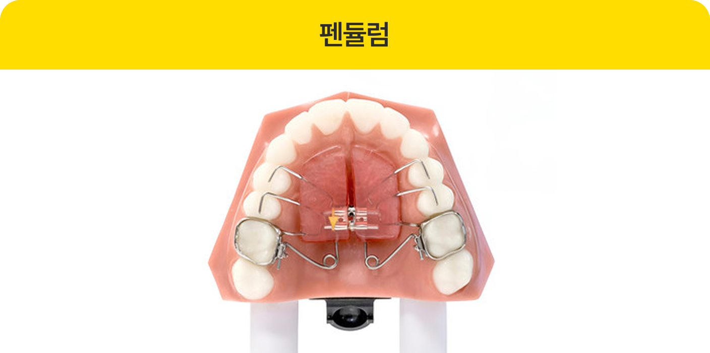 펜듈럼